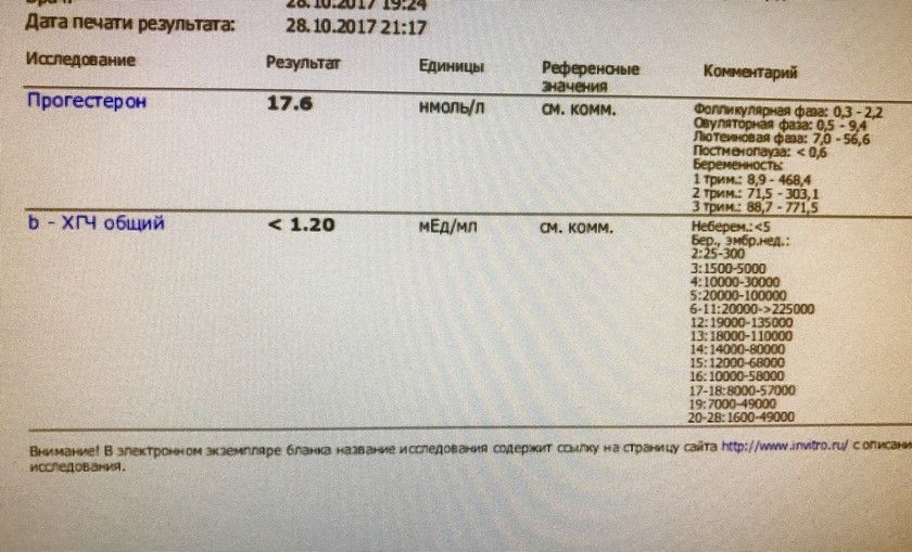 К чему беременной снится ребёнок 28