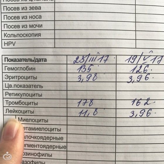 Когда сдавать посев из носа Когда сдавать посев из носа