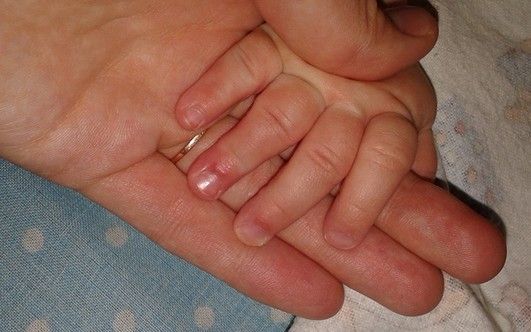 Что значит родинка под губами Что значит родинка под губами