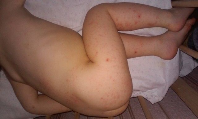 Как лезут зубы у новорожденных фото Как лезут зубы у новорожденных фото