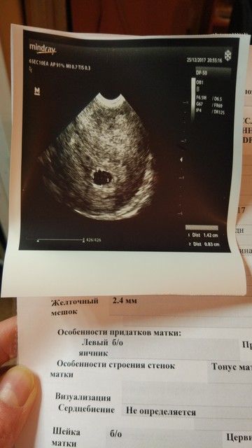 Беременная 5 недель фото 73