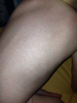 Опять я продолжение про сыпь у сына! Врачи как всегда не знают сказали ждите или пройдет или ... Опять я продолжение про сыпь у сына! Врачи как всегда не знают сказали ждите или пройдет или ...