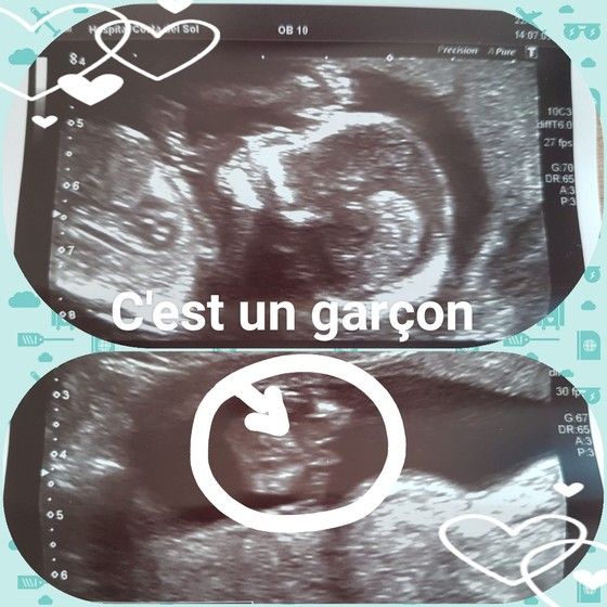 Наши новостя: узи, фоты, сахар.. и пол