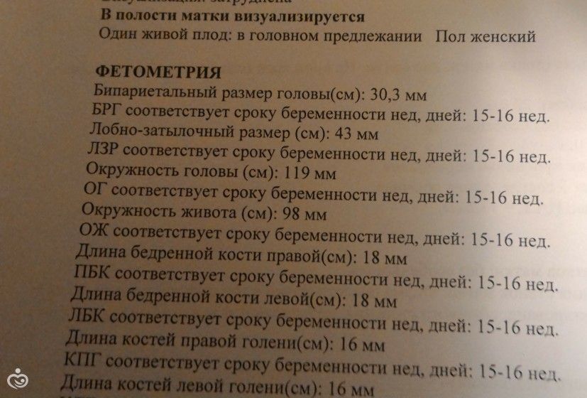 УЗИ и счастье!!!!:-)