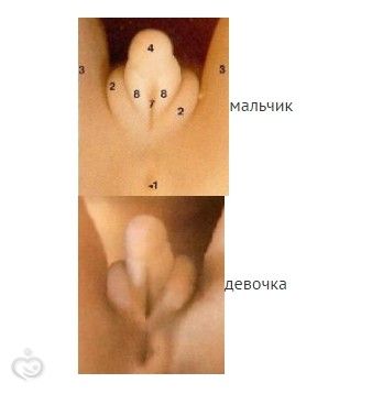 Первый скрининг 😍 сказали пол! Первый скрининг 😍 сказали пол!