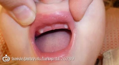 фото жемчужины эпштейна онлайн фото жемчужины эпштейна